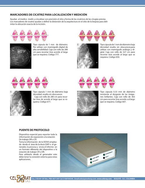 Accesorios de Mamografía - CELXRAY