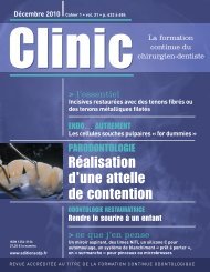 Réalisation d'une attelle de contention - WK-Pharma
