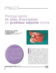 Piézographie et plan d'occlusion en prothèse adjointe totale