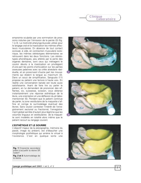 Piézographie et plan d'occlusion en prothèse adjointe totale