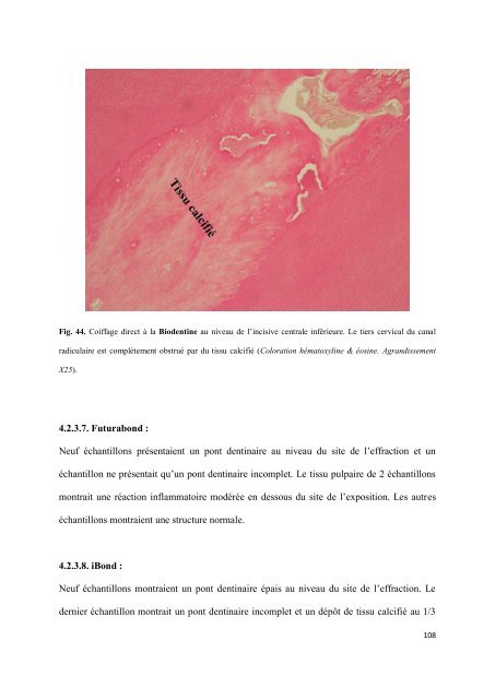 Les matériaux de coiffage et d'obturation pulpaire des dents lactéales