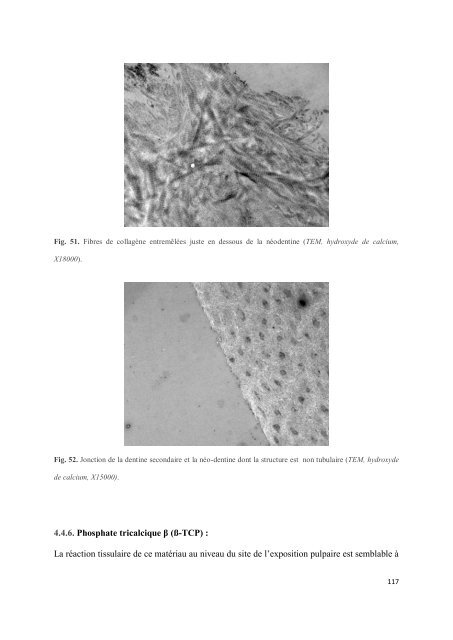 Les matériaux de coiffage et d'obturation pulpaire des dents lactéales