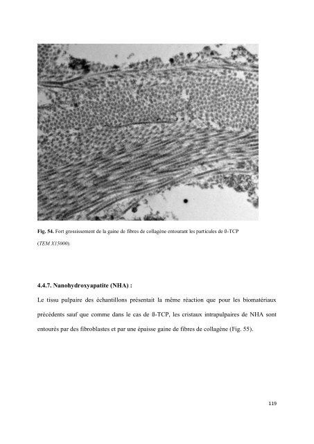 Les matériaux de coiffage et d'obturation pulpaire des dents lactéales