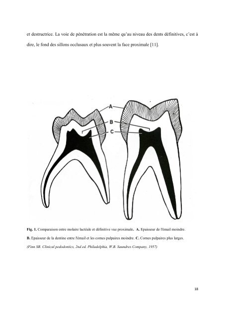 Les matériaux de coiffage et d'obturation pulpaire des dents lactéales