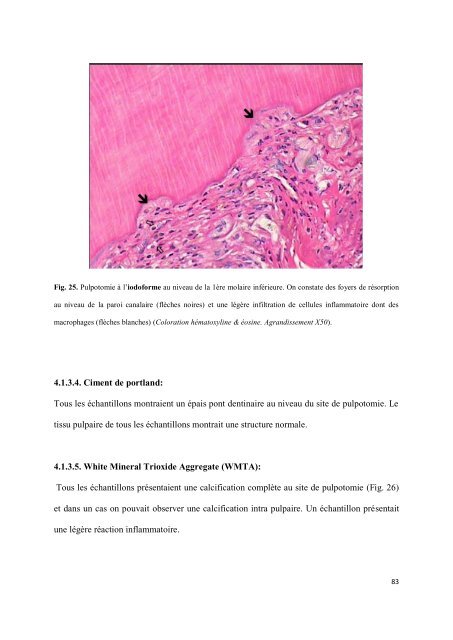 Les matériaux de coiffage et d'obturation pulpaire des dents lactéales