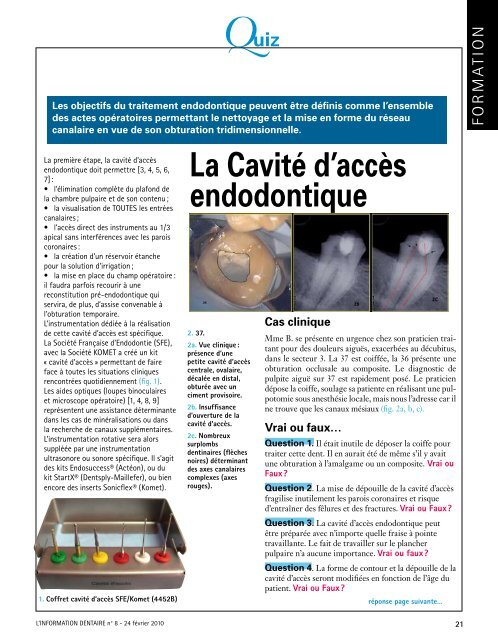 La Cavité d'accès endodontique - Kometdental.de