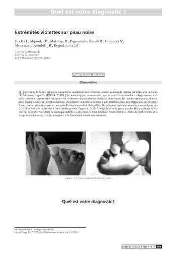 Quel est votre diagnostic ?