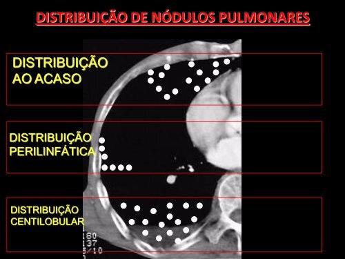 PATOLOGIAS - Comunidades