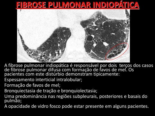 PATOLOGIAS - Comunidades