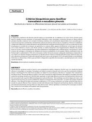 Critérios bioquímicos para classificar transudatos e exsudatos pleurais