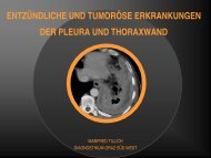 entzündliche und tumoröse erkrankungen der pleura und thoraxwand