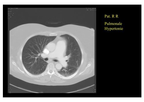 Pulmonale Hypertonie - HRZ Uni Marburg: Online-Media+CGI-Host