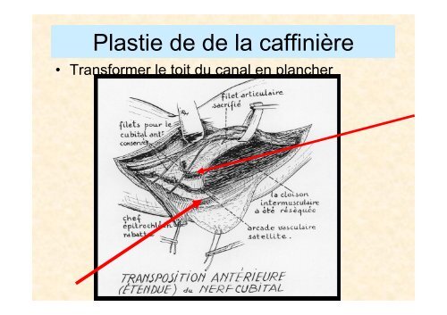 Chirurgie de la lèpre MY.Grauwin