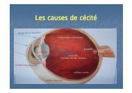Les causes de cécité [Mode de compatibilité] - Facmed-annaba.com
