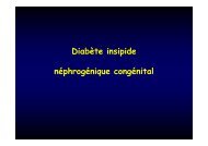 Diabète insipide, néphrogénique congénital - CHU Toulouse