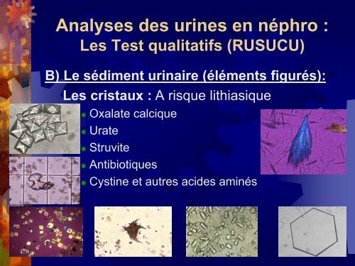 lanalyse des urines en nphrologie - Bienvenue au CHR de la Citadelle