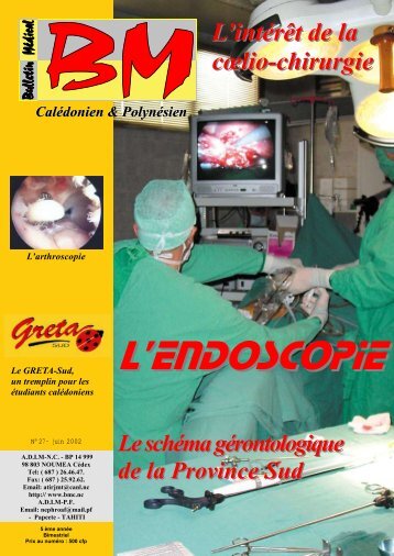 L'endoscopie