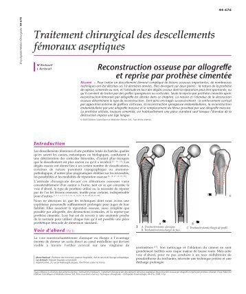 Traitement chirurgical des descellements fémoraux aseptiques ...