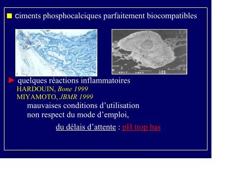 ciments phosphocalciques - GECO
