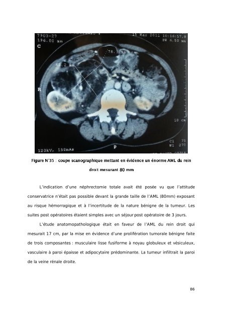 Graphique 1 - Faculté de Médecine et de Pharmacie de Fès