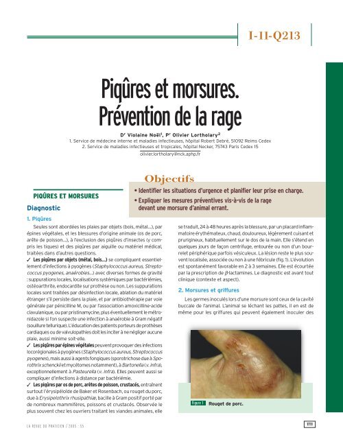 Piqûres Et Morsures Prévention De La Rage Free
