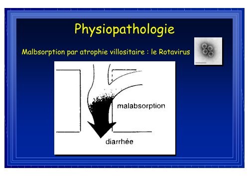 Diarrhee aigue et de..