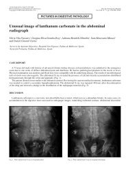 Unusual image of lanthanum carbonate in the abdominal radiograph