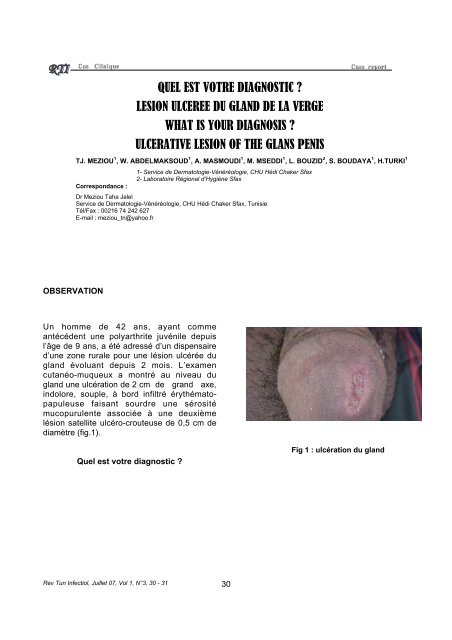 QUEL EST VOTRE DIAGNOSTIC ? LESION ULCEREE DU GLAND ...