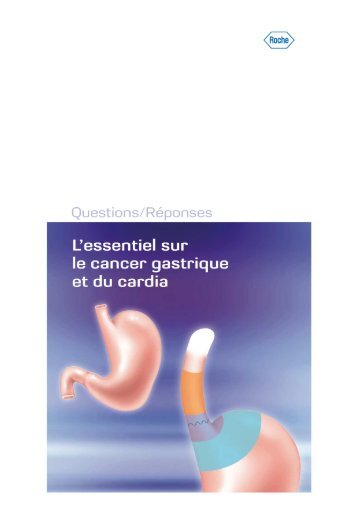 le cancer gastrique et du cardia