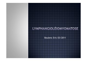 La lymphangioléiomyomatose - UBIR