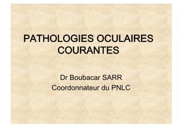 PATHOLOGIES OCULAIRES COURANTES