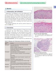 1. Inflammatory cell infiltration