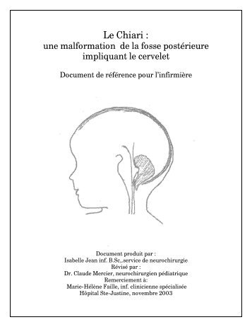 Le Chiari : - CHU Sainte-Justine
