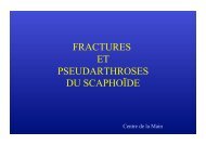 FRACTURES ET PSEUDARTHROSES DU SCAPHOÏDE - Sofcot