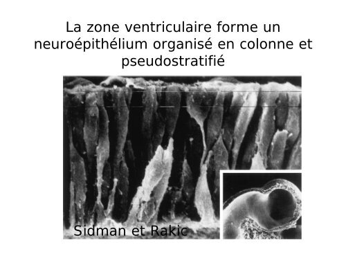 Neurogénèse et migration