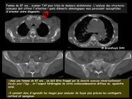 LM CC multiorgane mastocytose ostéo-médullaire - RADIOLOGIE ...