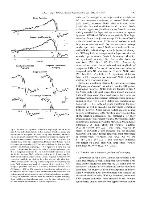 Motoric response inhibition in finger movement and saccadic eye ...