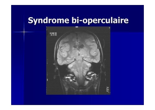 Examen neurologique et langage - Réseau Santé Langage