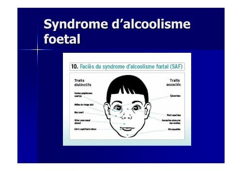 Examen neurologique et langage - Réseau Santé Langage