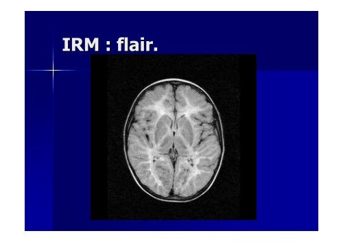 Examen neurologique et langage - Réseau Santé Langage