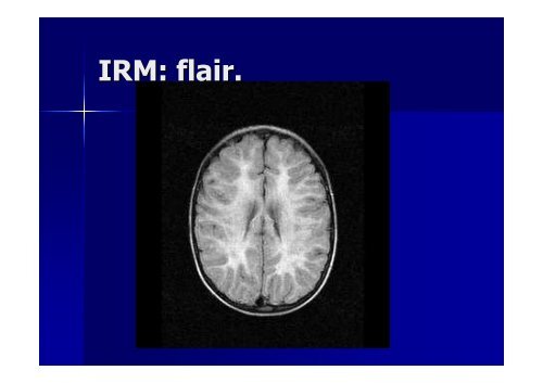 Examen neurologique et langage - Réseau Santé Langage