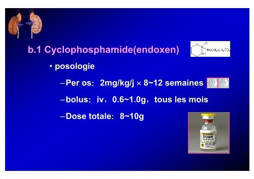 S d Né h ti (SN) Syndrome Néphrotique (SN) 肾病综合征