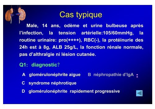 S d Né h ti (SN) Syndrome Néphrotique (SN) 肾病综合征