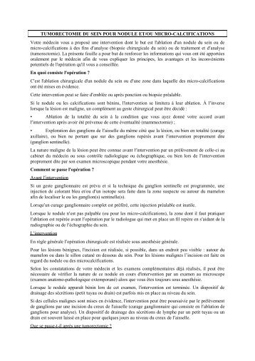 TUMORECTOMIE DU SEIN POUR NODULE ET ... - (CHU) de Poitiers