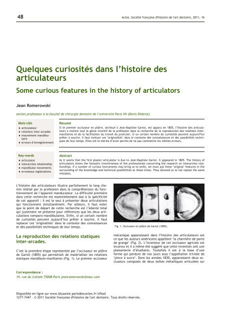 Quelques curiosités dans l'histoire des articulateurs