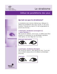 déviation des axes visuels - Canadian Ophthalmological Society