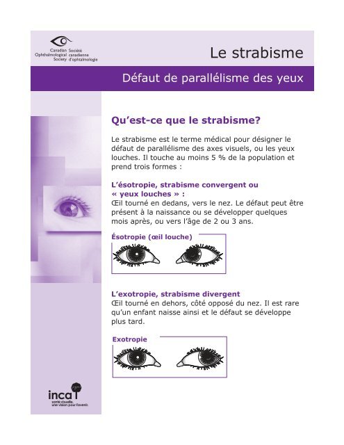 déviation des axes visuels - Canadian Ophthalmological Society