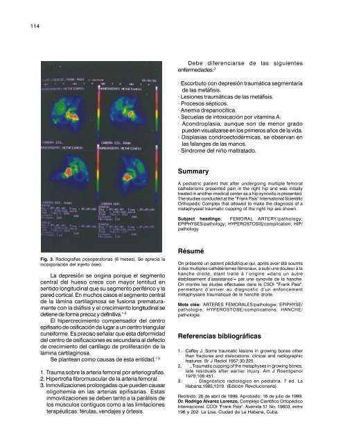 revistacubanade