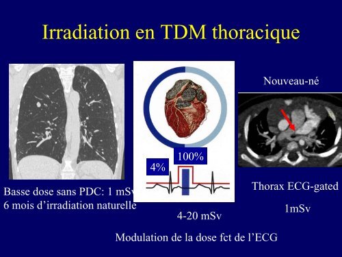 Importance de l'imagerie tomodensitométrique pour le diagnostic de ...