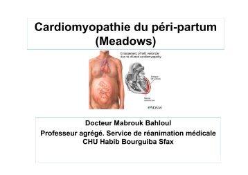 Cardiomyopathie du péri-partum (Meadows) - ATuRea